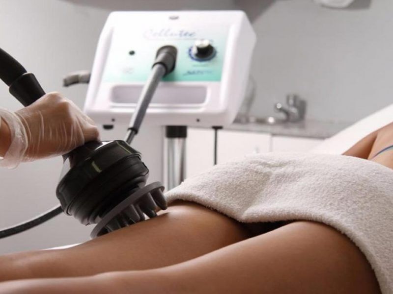 Cellulitenmassage